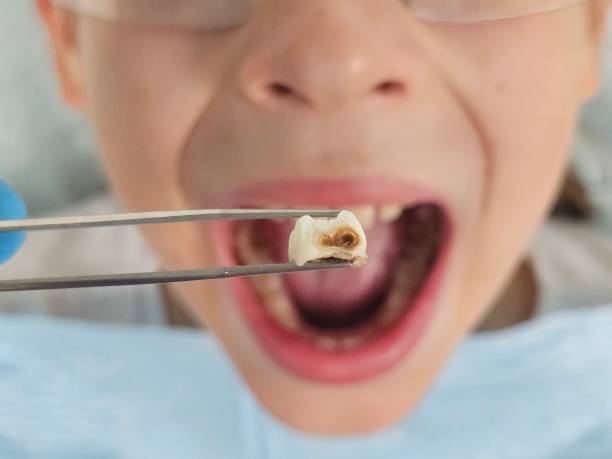 Best Emergency Gum Pain Relief  in Xenia, OH